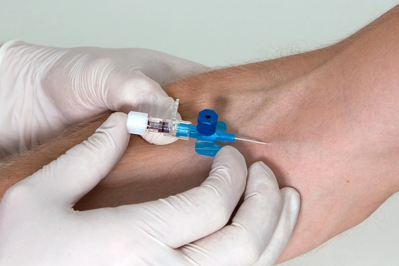 Cannulation